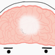 smaller man laying in brain